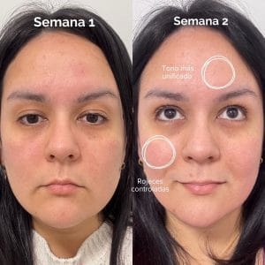 mascara led de currentbody resultados reales 1