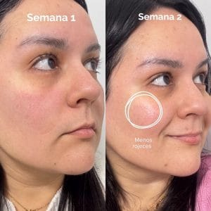 mascara led de currentbody resultados reales 2