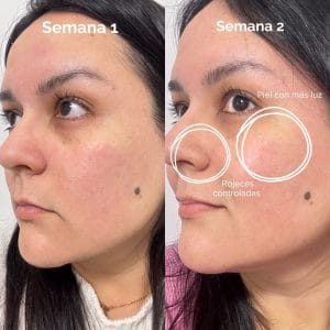 mascara led de currentbody resultados reales 3