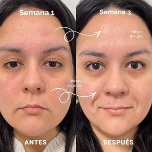 mascara led de currentbody resultados reales 4