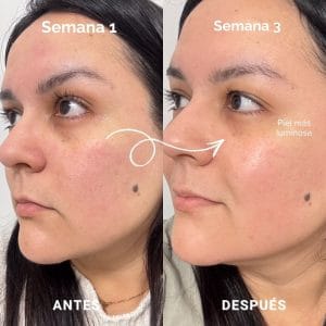 mascara led de currentbody resultados reales 5