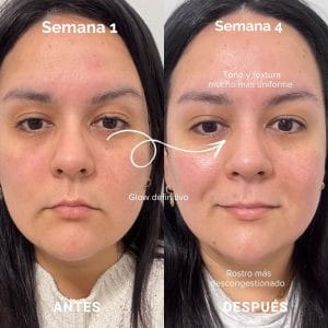 mascara led de currentbody resultados reales 7