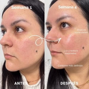 mascara led de currentbody resultados reales 8