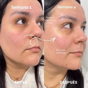 mascara led de currentbody resultados reales 9